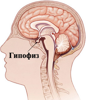 Заболевания надпочечников и гипофиза — лечение, симптомы, диагностика